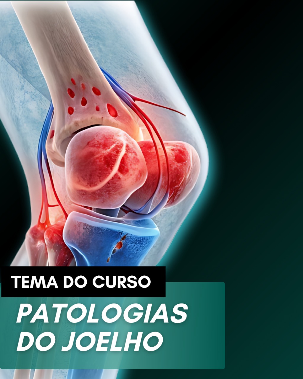 banner da atividade VI Curso Introdutório - Patologias do Joelho